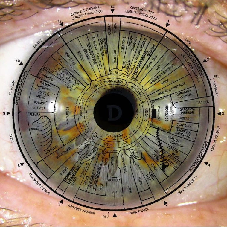 Iridología